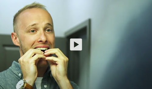 How Invisalign works